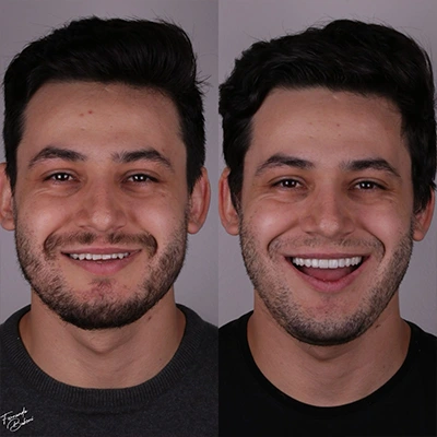 Antes-e-depois-novo1